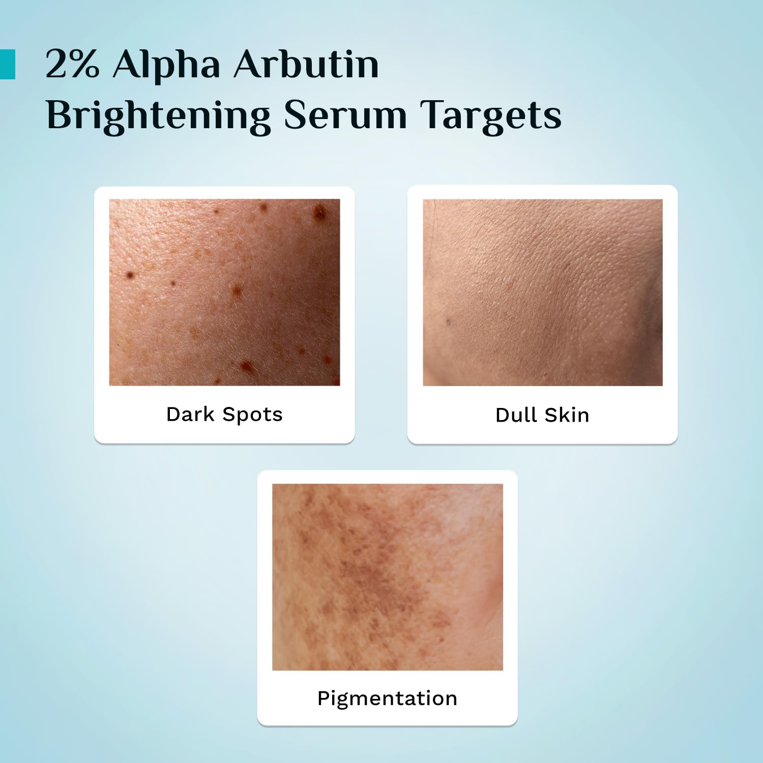 PILGRIM Korean 2% Alpha Arbutin & 3% Vitamin C Brightening Face Serum for glowing skin| Alpha arbutin face serum|All skin typ