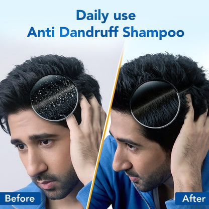 Scalpe Pro Daily Dandruff Care Shampoo with Climbazole and ZPTO, Unisex for Women and Men - back view (9)