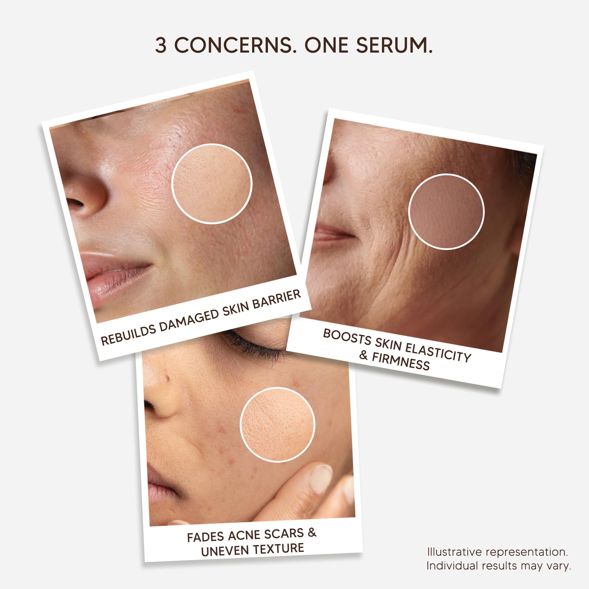 Soyaang 96% Snail Mucin Revitalizing Serum with Niacinamide & Aloe Vera | Repairs Acne Scars, Boosts Hydration & Firms Skin |
