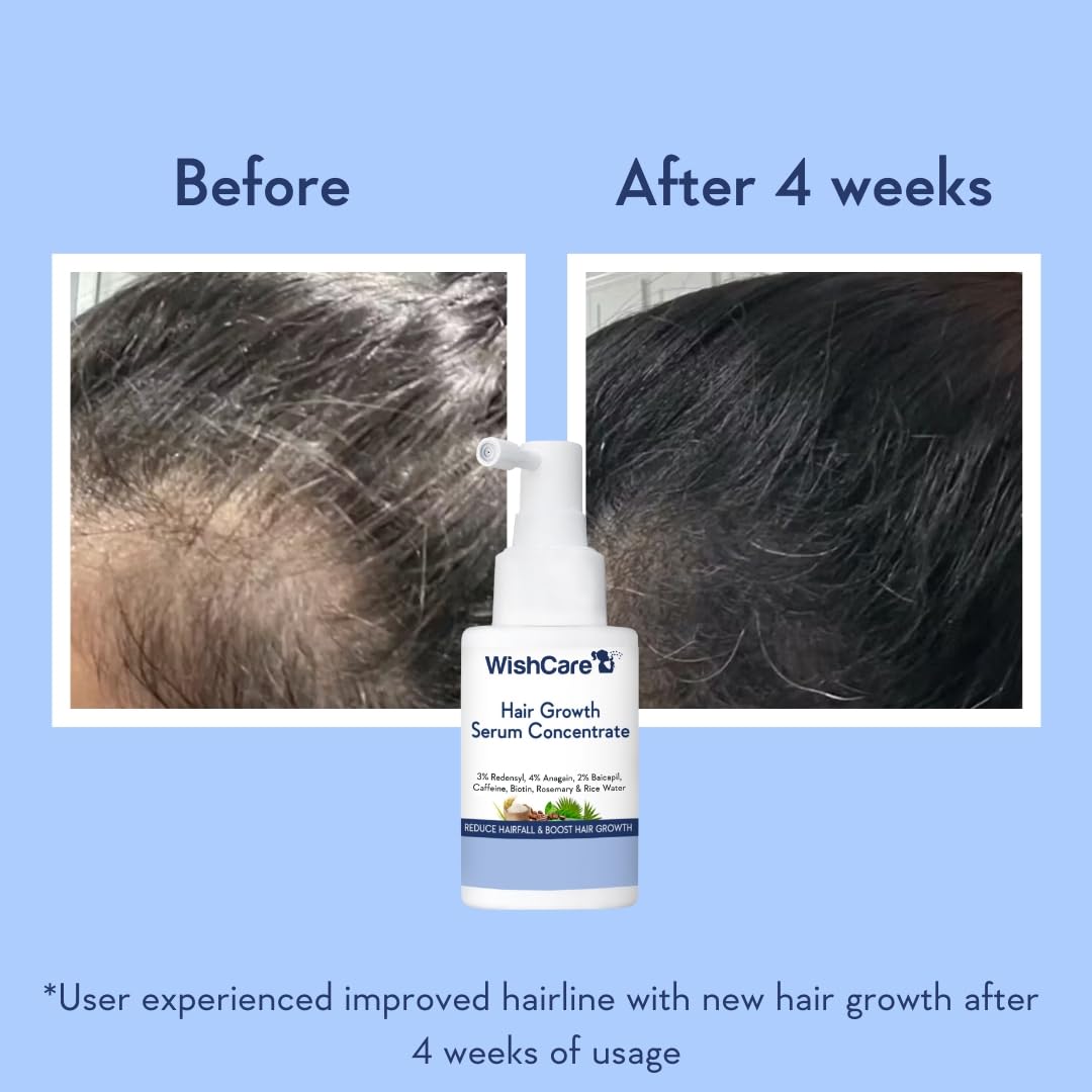 WishCare Hair Growth Serum Concentrate with Resdensyl, Anagain, Caffeine, Biotin, Keratin & Rice Water, Leave-On Formula - fr