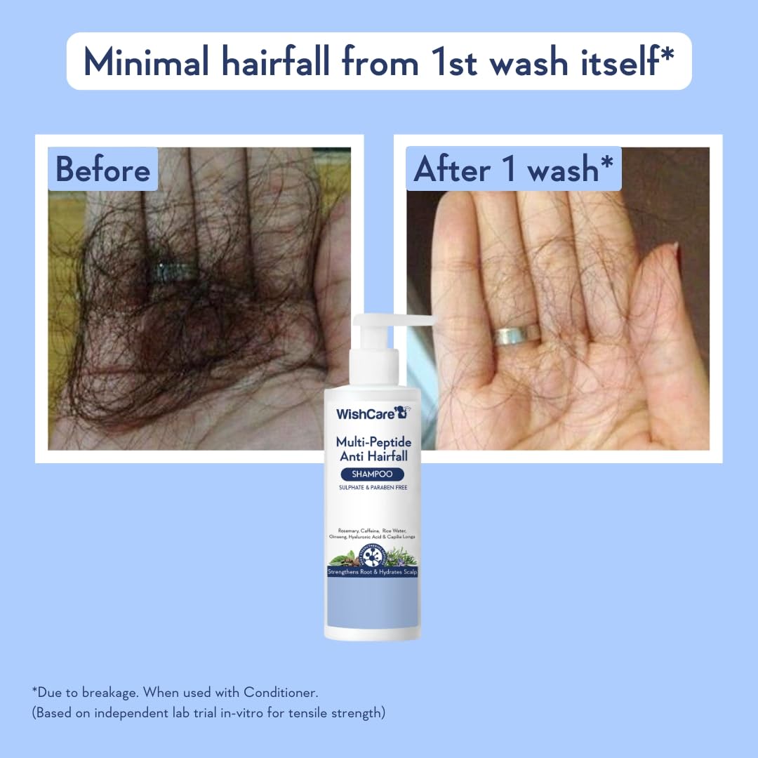 WishCare Hair Growth Serum Concentrate with Resdensyl, Anagain, Caffeine, Biotin, Keratin & Rice Water, Leave-On Formula - ba