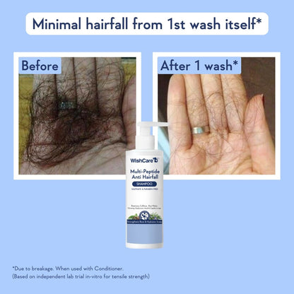 WishCare Hair Growth Serum Concentrate with Resdensyl, Anagain, Caffeine, Biotin, Keratin & Rice Water, Leave-On Formula - ba