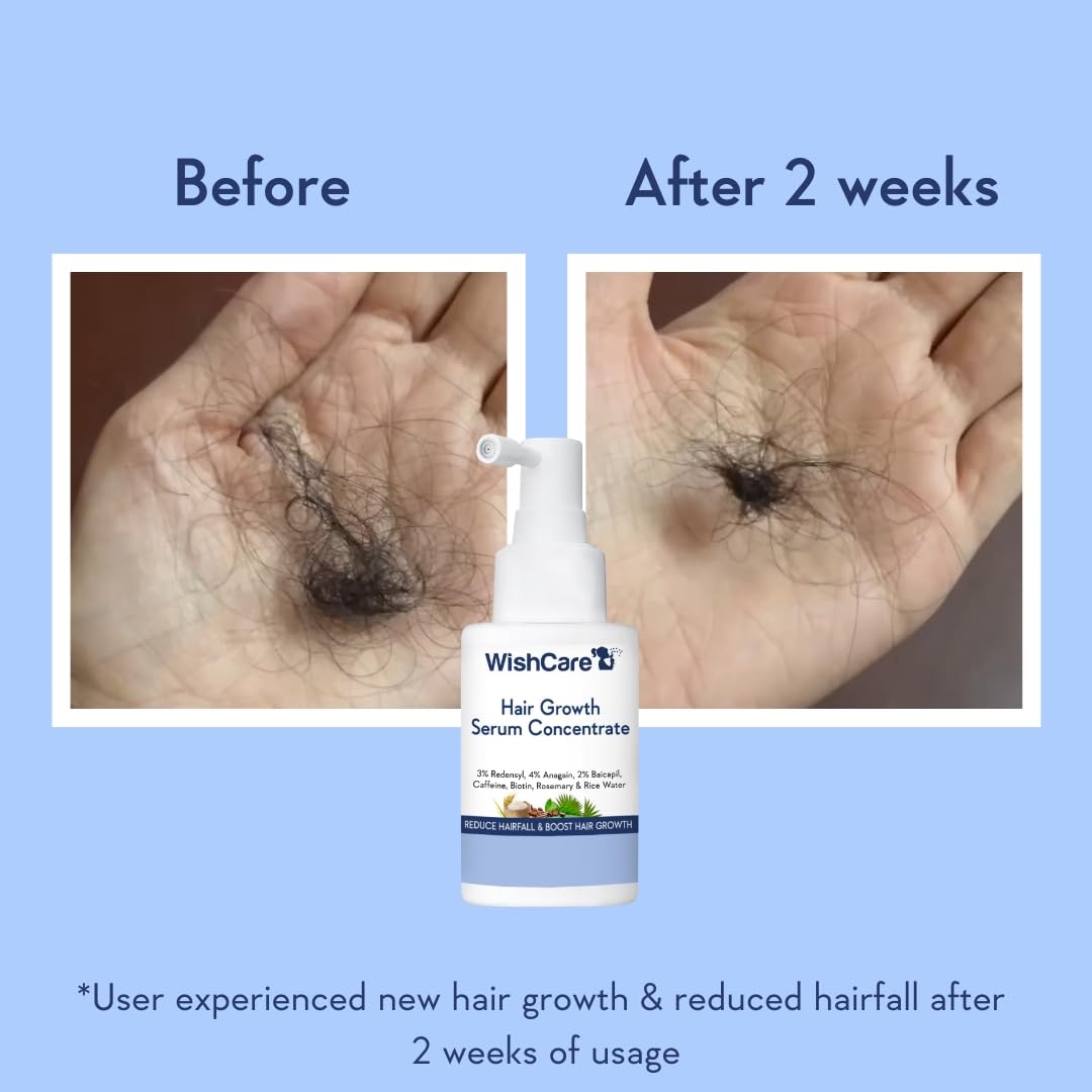 WishCare Hair Growth Serum Concentrate with Resdensyl, Anagain, Caffeine, Biotin, Keratin & Rice Water, Leave-On Formula - pa