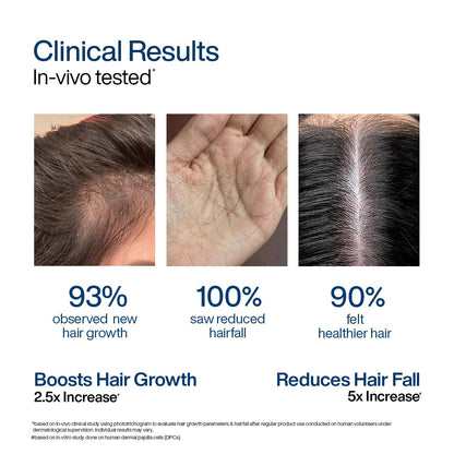 WishCare Hair Growth Serum Concentrate with Resdensyl, Anagain, Caffeine, Biotin, Keratin & Rice Water, Leave-On Formula - ba