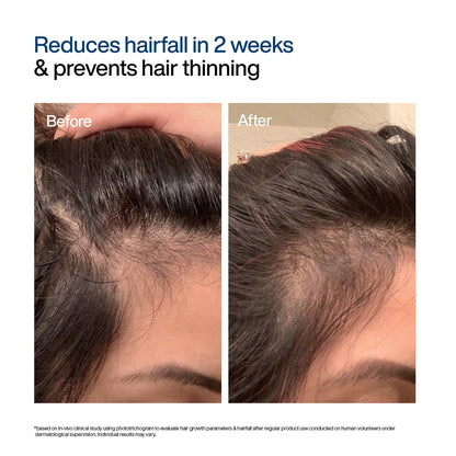 WishCare Hair Growth Serum Concentrate with Resdensyl, Anagain, Caffeine, Biotin, Keratin & Rice Water, Leave-On Formula - la