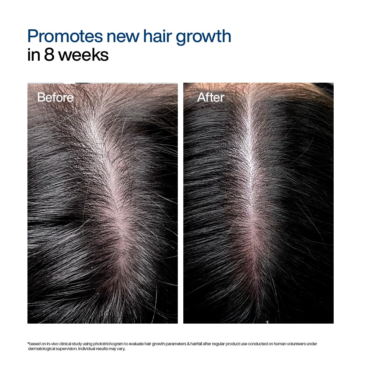 WishCare Hair Growth Serum Concentrate with Resdensyl, Anagain, Caffeine, Biotin, Keratin & Rice Water, Leave-On Formula - in