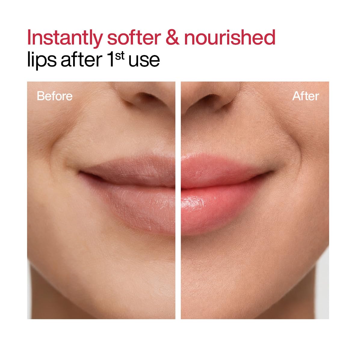 WishCare Lip Balm Combo, Tinted and Untinted, with Kojic Acid & Niacinamide, Hydrating Lip Balm Set - back view