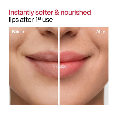 WishCare Lip Balm Combo, Tinted and Untinted, with Kojic Acid & Niacinamide, Hydrating Lip Balm Set - back view
