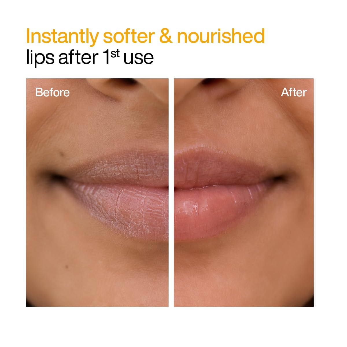 WishCare Lip Balm Combo, Tinted and Untinted, with Kojic Acid & Niacinamide, Hydrating Lip Balm Set - packaging